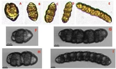 Imaging Technologies Build Capacity and Accessibility in Phytoplankton Species Identification Expertise for Research and Monitoring: Lessons Learned During the COVID-19 Pandemic